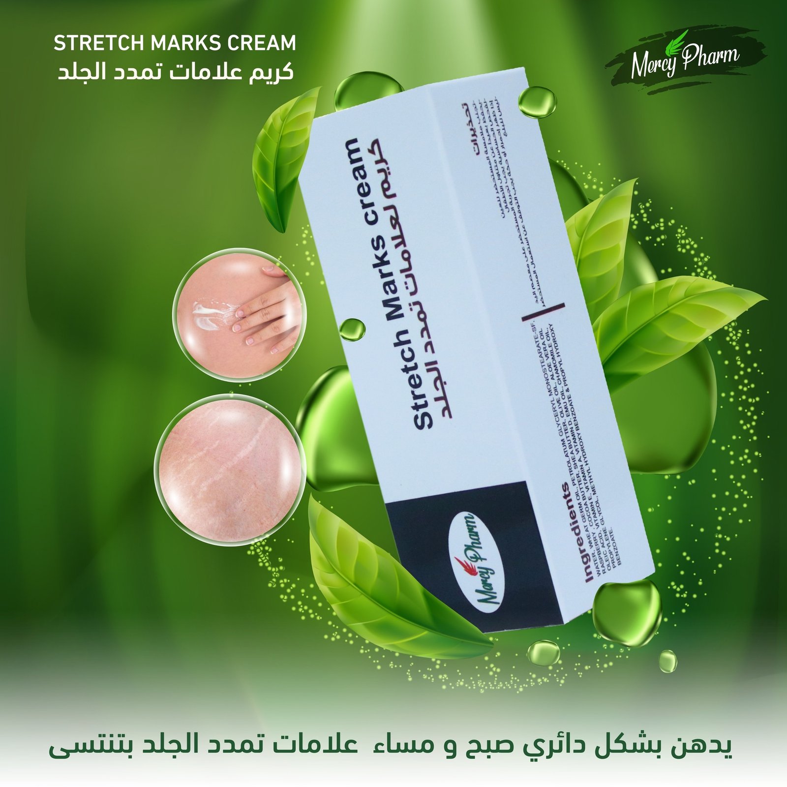 Stretch Marks Cream